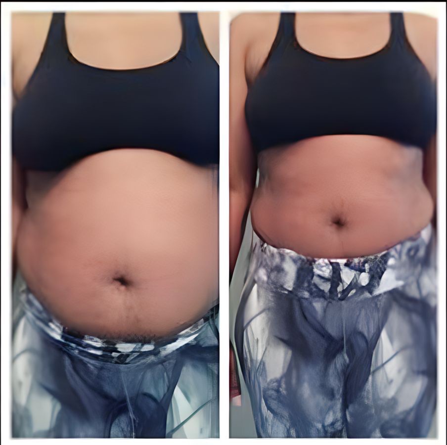 Before and after of a woman's stomach.