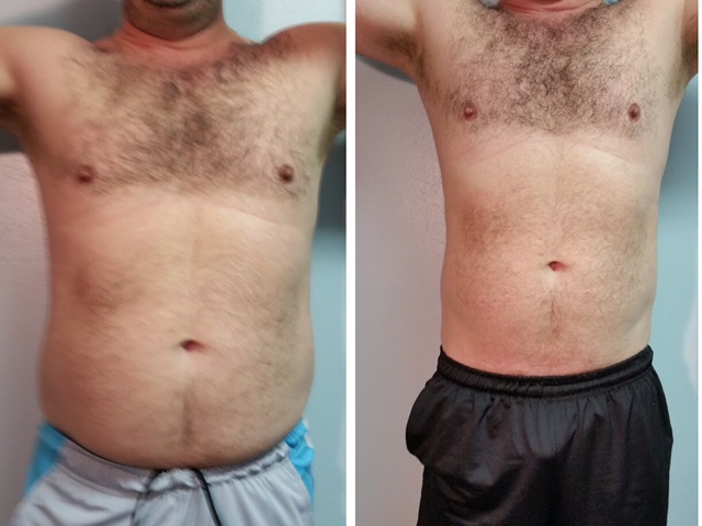 Before and after of a man's torso.