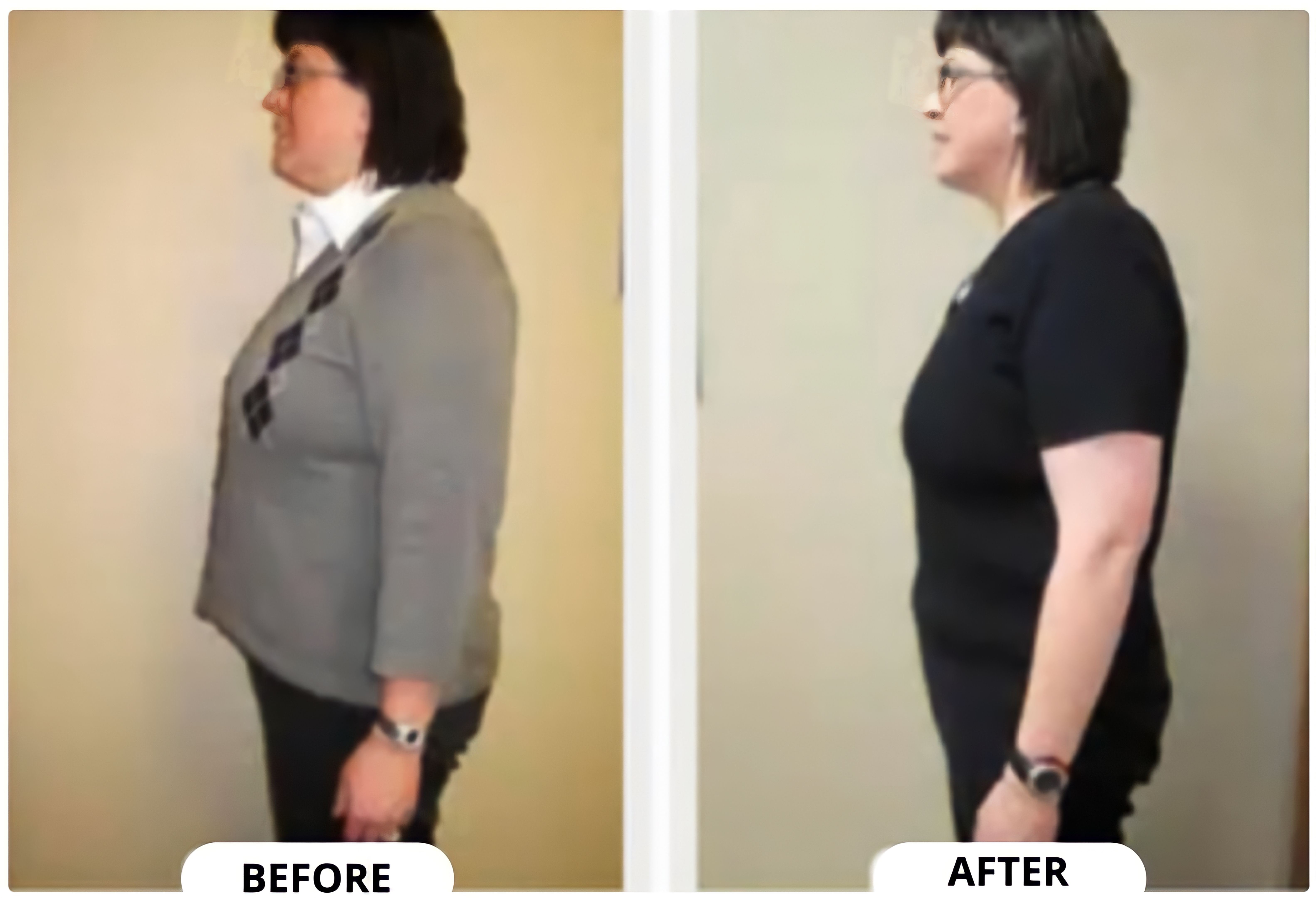 Side profile before and after of a woman in a sweater.